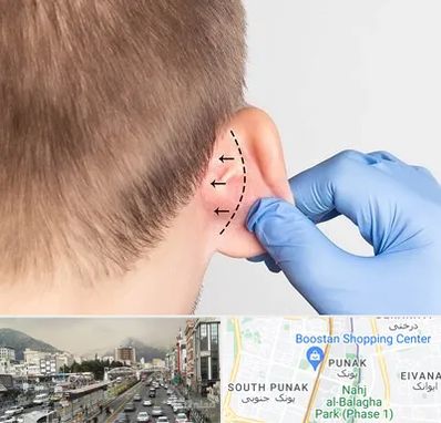 عمل زیبایی گوش در پونک