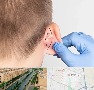 عمل زیبایی گوش در فاز سه اندیشه