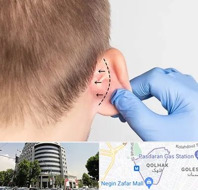 عمل زیبایی گوش در قلهک
