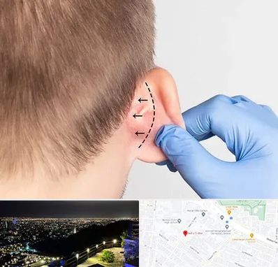 عمل زیبایی گوش در هفت تیر مشهد