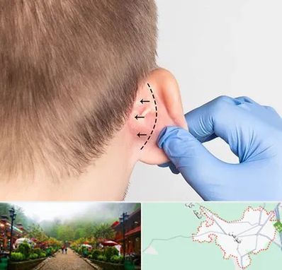 عمل زیبایی گوش در فومن