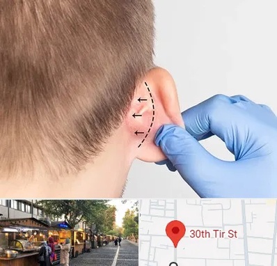 عمل زیبایی گوش در سی تیر