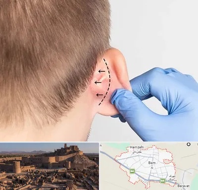 عمل زیبایی گوش در بم