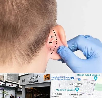 عمل زیبایی گوش در منیریه