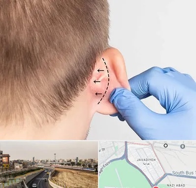 عمل زیبایی گوش در جوادیه