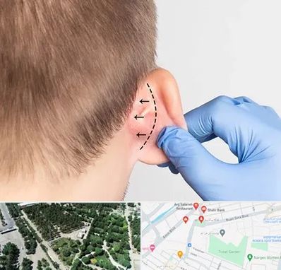 عمل زیبایی گوش در سالاریه قم