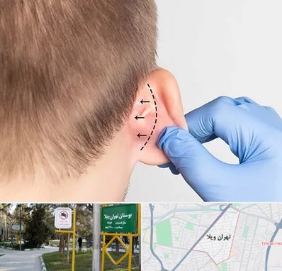 عمل زیبایی گوش در تهران ویلا
