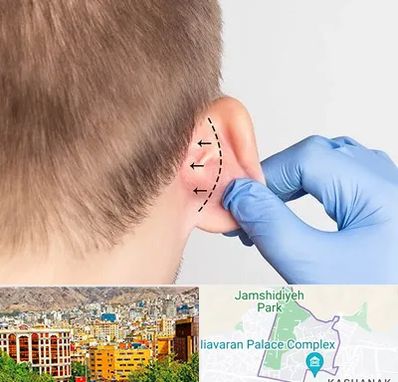 عمل زیبایی گوش در نیاوران