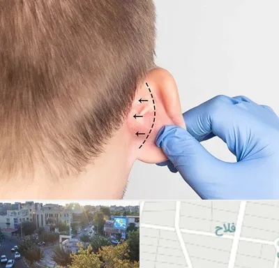 عمل زیبایی گوش در فلاح