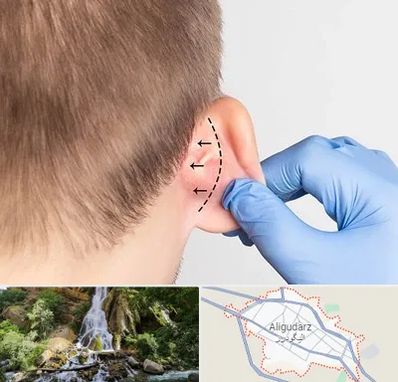 عمل زیبایی گوش در الیگودرز