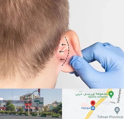 عمل زیبایی گوش در هروی