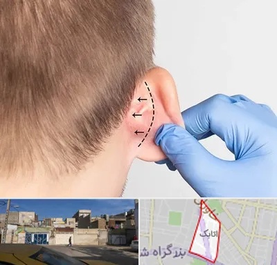 عمل زیبایی گوش در اتابک