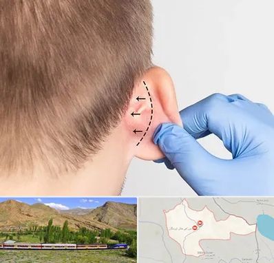 عمل زیبایی گوش در خاش