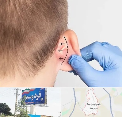 عمل زیبایی گوش در فردوسیه شهریار