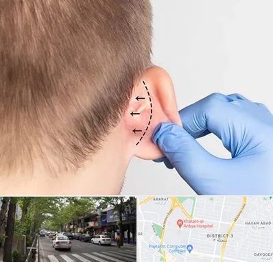 عمل زیبایی گوش در ظفر