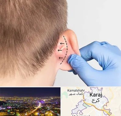 عمل زیبایی گوش در کرج