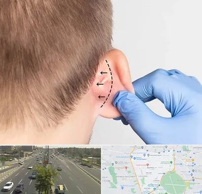 عمل زیبایی گوش در منطقه 17 تهران