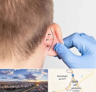 عمل زیبایی گوش در قم