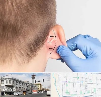 عمل زیبایی گوش در 17شهریور