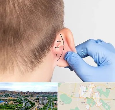 عمل زیبایی گوش در شهریار