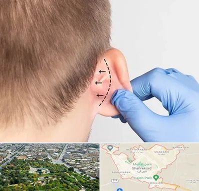 عمل زیبایی گوش در شهرکرد