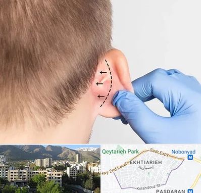 عمل زیبایی گوش در اختیاریه