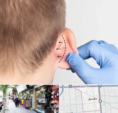عمل زیبایی گوش در سلسبیل