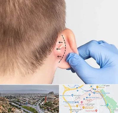 عمل زیبایی گوش در معالی آباد شیراز