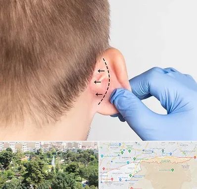 عمل زیبایی گوش در منطقه 13 تهران