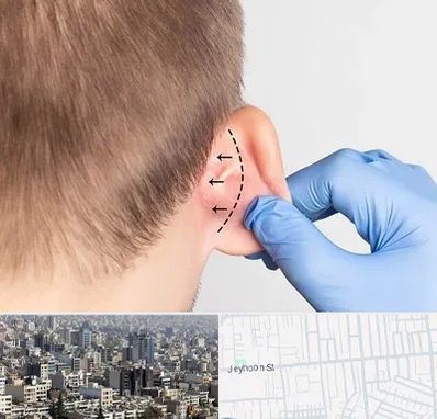 عمل زیبایی گوش در جیحون
