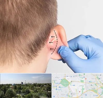 عمل زیبایی گوش در منطقه 16 تهران