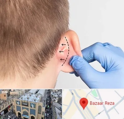 عمل زیبایی گوش در بازار رضا مشهد