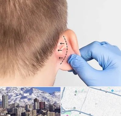 عمل زیبایی گوش در ازگل