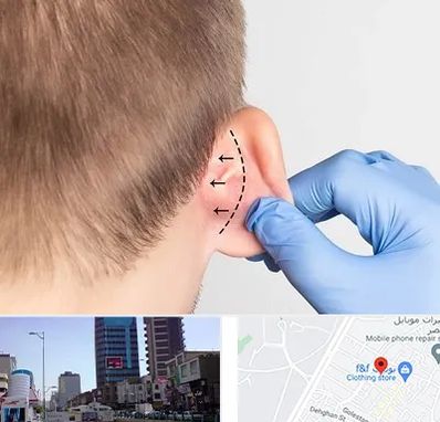 عمل زیبایی گوش در چهارراه طالقانی کرج