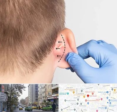 عمل زیبایی گوش در فاطمی