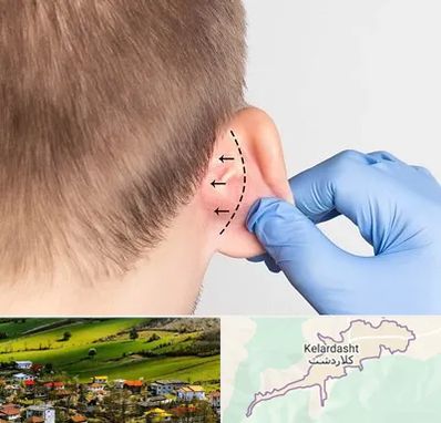 عمل زیبایی گوش در کلاردشت