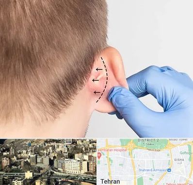 عمل زیبایی گوش در مرزداران