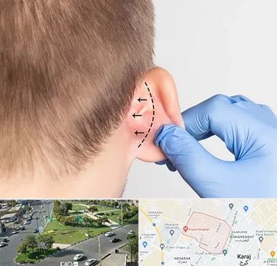 عمل زیبایی گوش در شاهین ویلا کرج