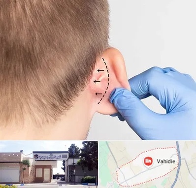 عمل زیبایی گوش در وحیدیه شهریار