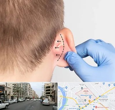 عمل زیبایی گوش در زیتون کارمندی اهواز