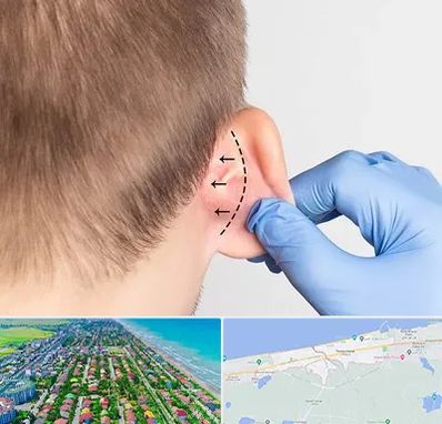 عمل زیبایی گوش در فریدونکنار