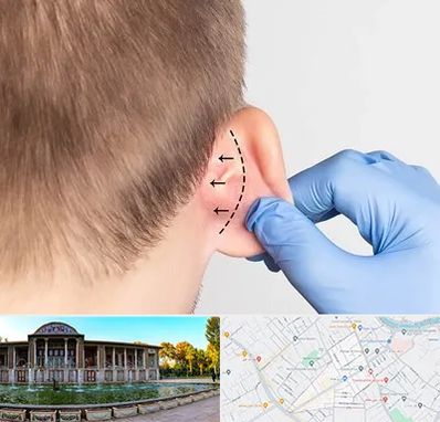 عمل زیبایی گوش در عفیف آباد شیراز