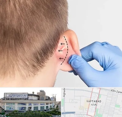 عمل زیبایی گوش در یافت آباد