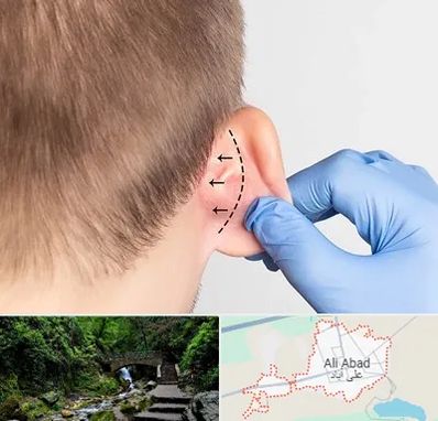 عمل زیبایی گوش در علی آباد کتول