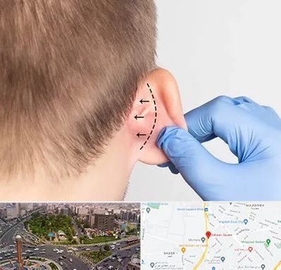 عمل زیبایی گوش در سبلان