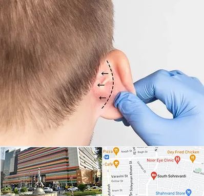 عمل زیبایی گوش در سهروردی