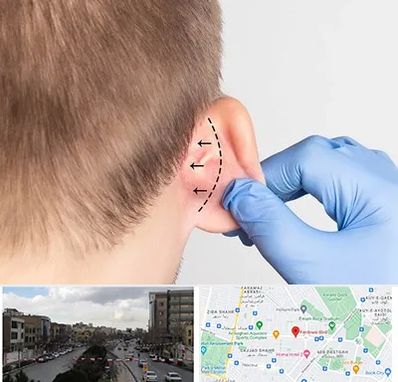 عمل زیبایی گوش در بلوار فردوسی مشهد