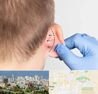 عمل زیبایی گوش در شرق تهران تهران