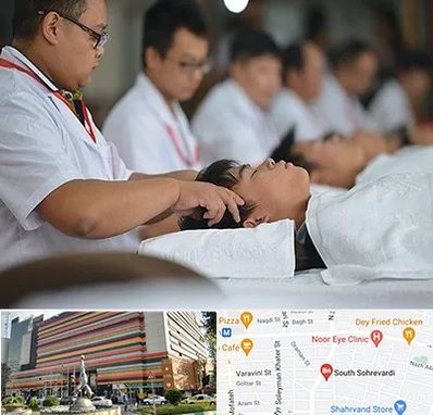 طب چینی در سهروردی 