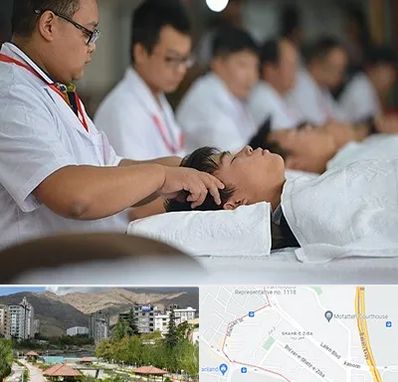 طب چینی در شهر زیبا 